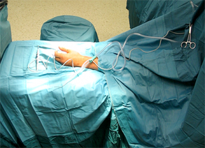 Typische Lagerung und sterile Abdeckung bei einer Handoperation